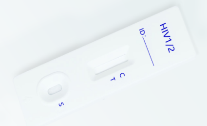 HIV Tip 1 Tip 2 Hızlı Test Kombo Kaseti Antikorları