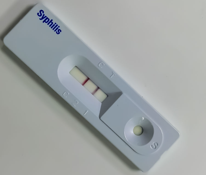 Sifiliz Antijeni Hızlı Test Şeridi